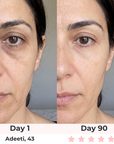 Skin Happy Red Light Under-Eye Glasses