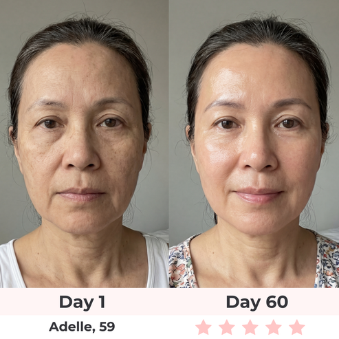 7-in-1 LED Face Mask