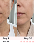 7-in-1 LED Face Mask