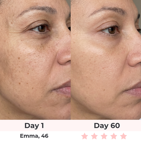 Skin Happy Red Light Under-Eye Glasses