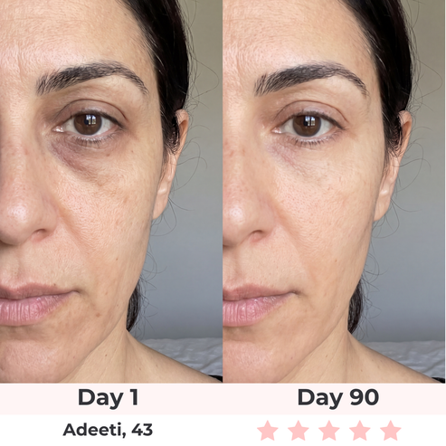 Skin Happy Red Light Under-Eye Glasses
